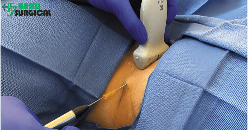 Cryoneurolysis: Cooling Away Pain