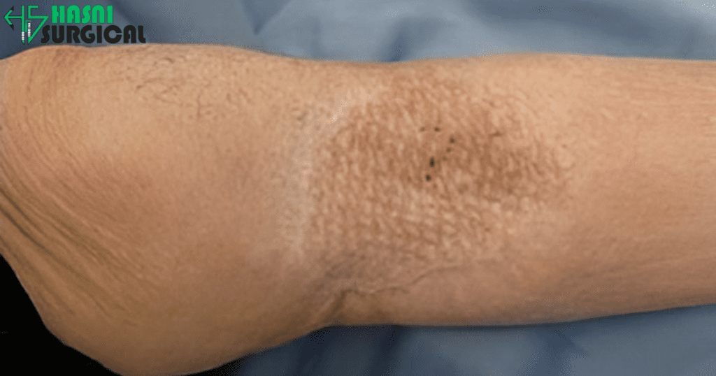 Forceps and Needle Holders