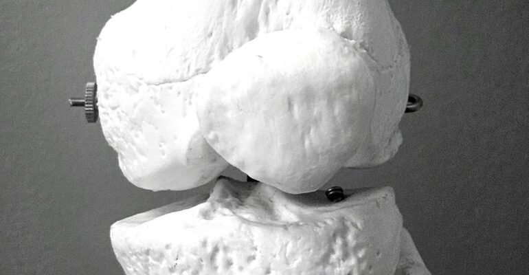 Detailed anatomical model of human knee bone structure used in orthopedic surgery and bone implant procedures