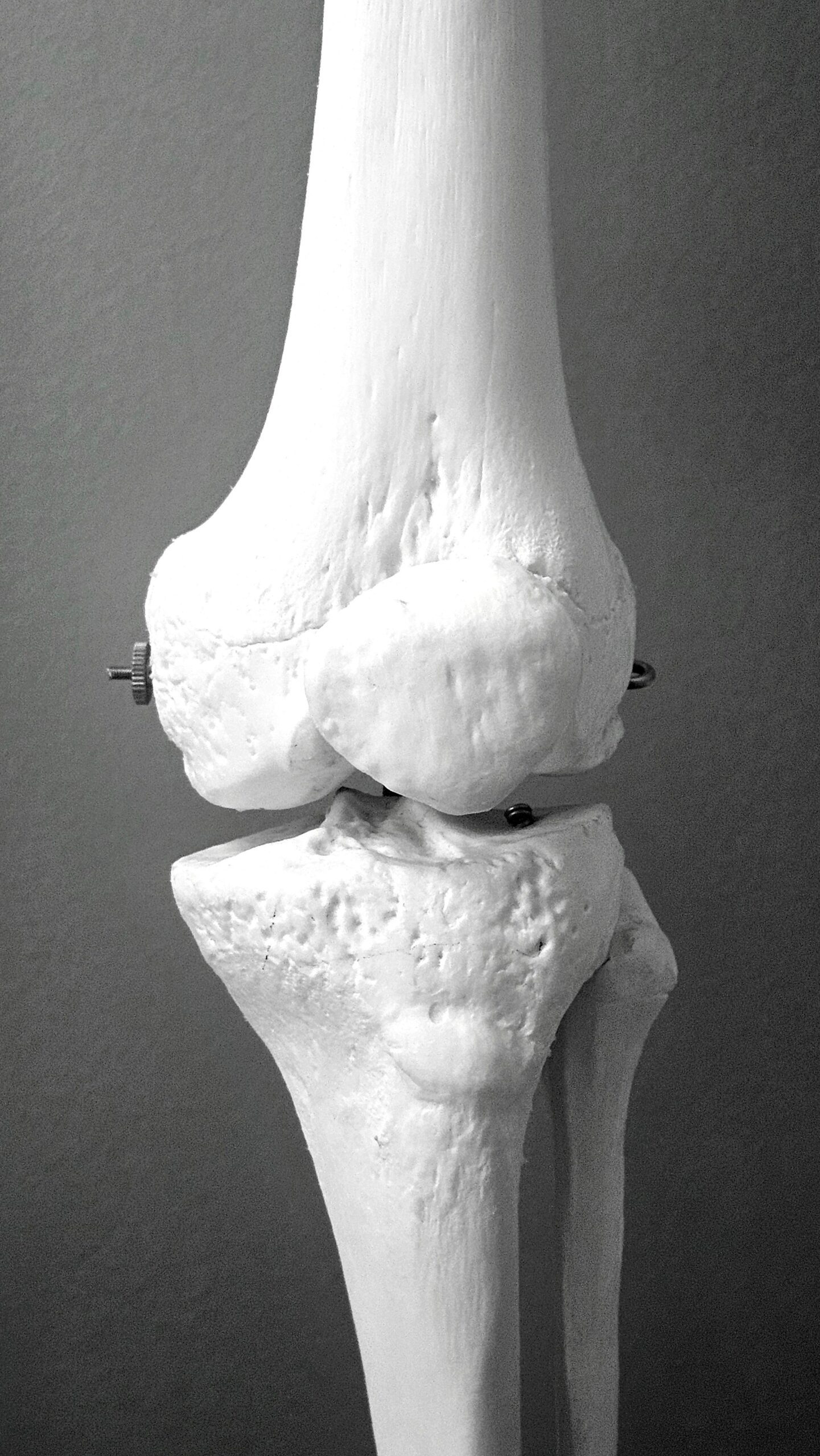 Detailed anatomical model of human knee bone structure used in orthopedic surgery and bone implant procedures