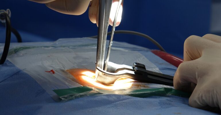 Close-up detailed view of spinal surgery procedure in hospital operating room with surgical tools and instruments