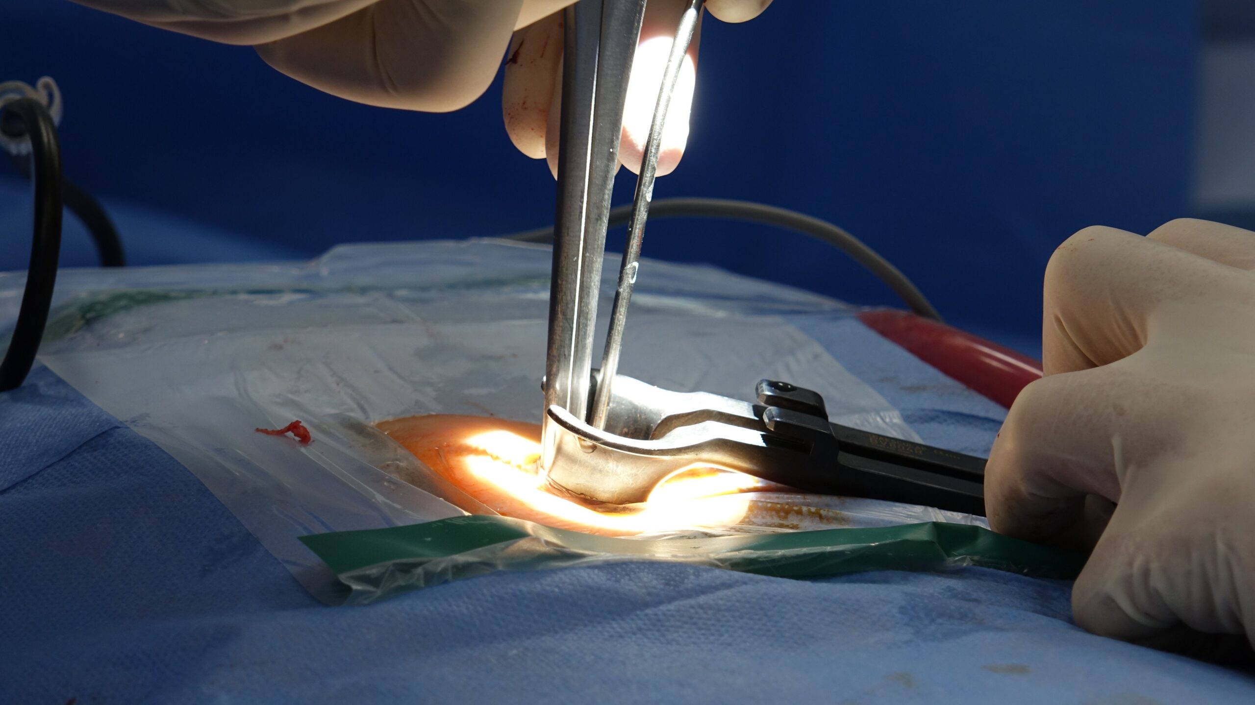 Close-up detailed view of spinal surgery procedure in hospital operating room with precision surgical instruments
