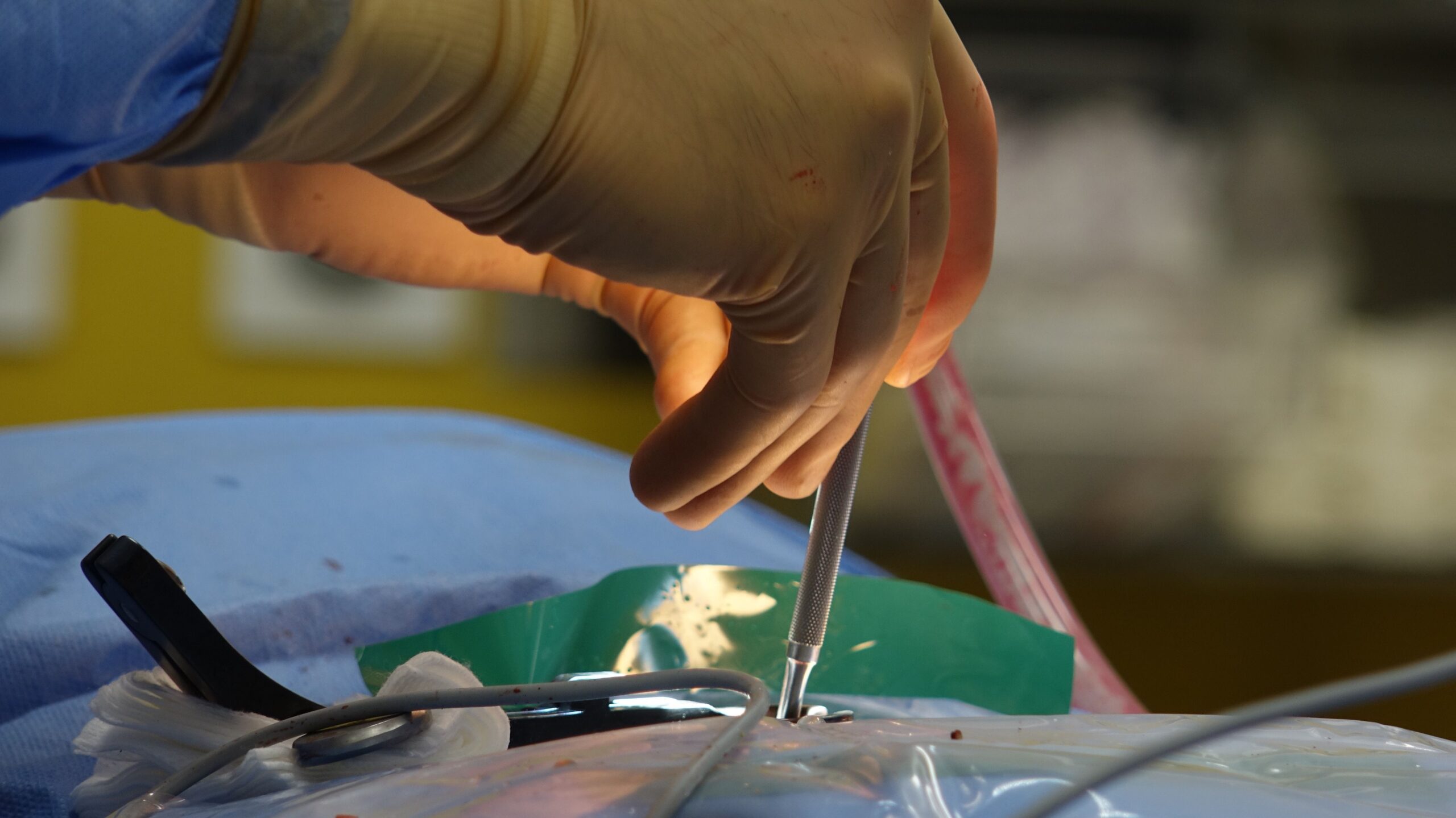 Detailed view of surgical operation with precision medical instruments being used during spinal decompression procedure