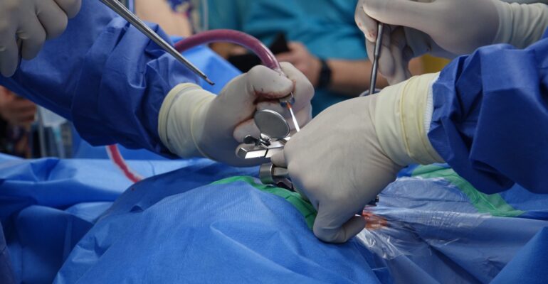 Surgeons in sterile gloves performing precise spinal stabilization operation in modern operating room with advanced instruments