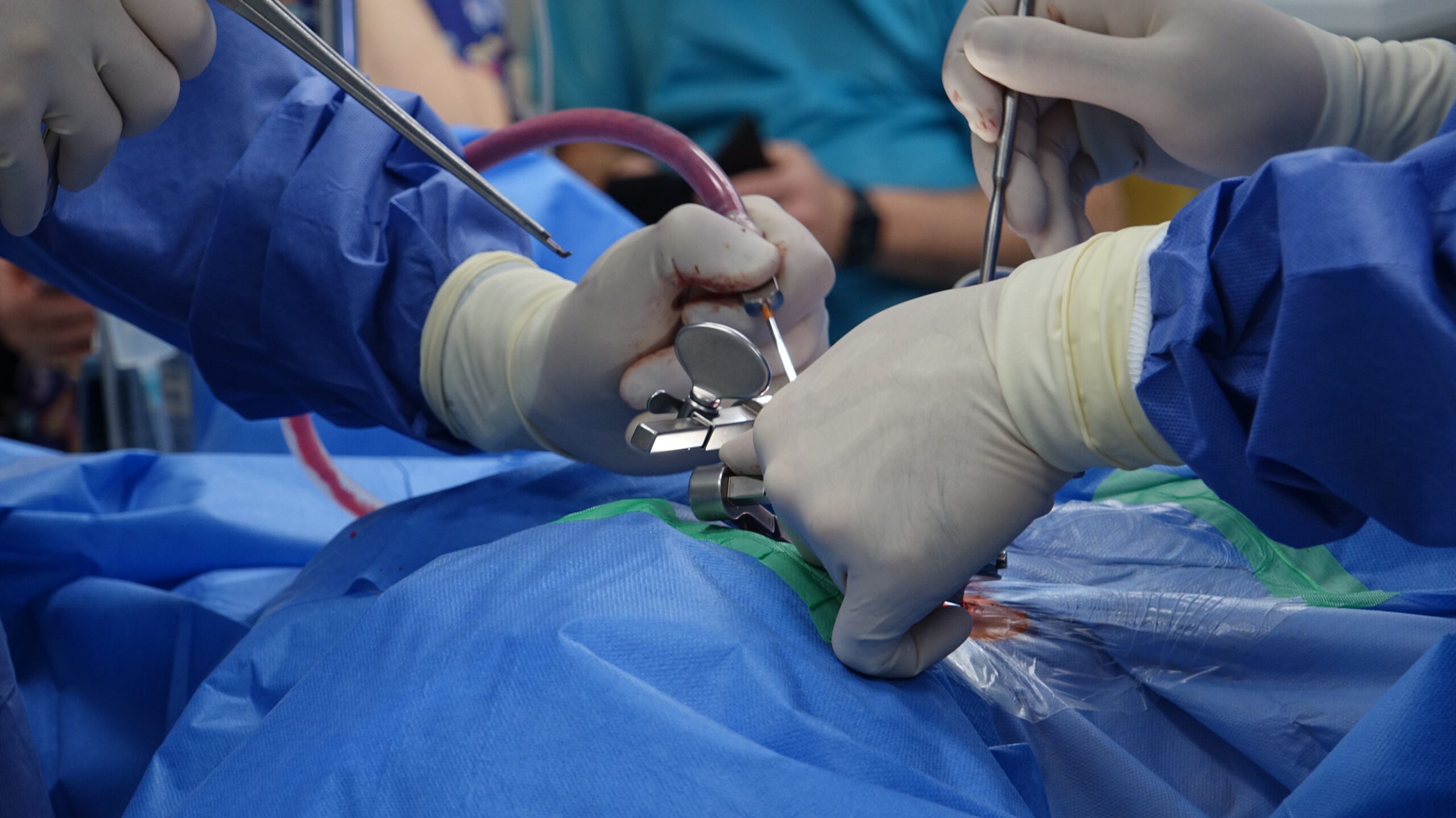 Surgeons in sterile gloves performing precise spinal stabilization operation in modern operating room