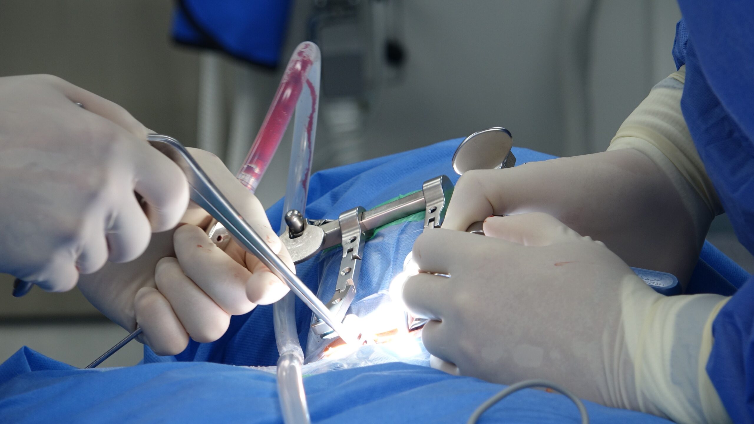 Specialized surgical team performing complex spinal fixation surgery with precision instruments and sterile equipment