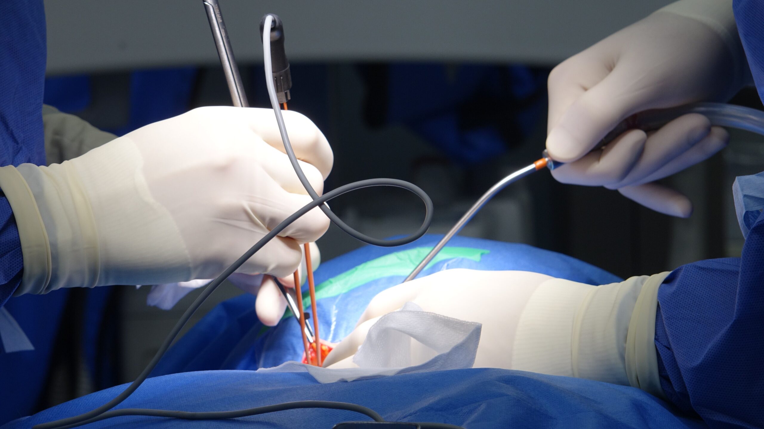 Surgeons performing delicate spinal stabilization operation with precision instruments and sterile surgical gloves in OR